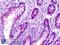 PEAK1 Related, Kinase-Activating Pseudokinase 1 antibody, LS-B6356, Lifespan Biosciences, Immunohistochemistry paraffin image 