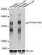 Protein Tyrosine Phosphatase Receptor Type A antibody, LS-C750621, Lifespan Biosciences, Western Blot image 