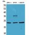 Fibroblast Growth Factor 12 antibody, PA5-51076, Invitrogen Antibodies, Western Blot image 