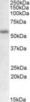 Growth hormone-inducible transmembrane protein antibody, 42-506, ProSci, Western Blot image 