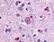 Glutamate Metabotropic Receptor 1 antibody, NLS879, Novus Biologicals, Immunohistochemistry frozen image 