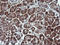 Parvin Alpha antibody, LS-C787967, Lifespan Biosciences, Immunohistochemistry paraffin image 