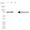 Bruton Tyrosine Kinase antibody, NBP1-78295, Novus Biologicals, Western Blot image 