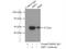 Actin Related Protein 3 antibody, 13822-1-AP, Proteintech Group, Immunoprecipitation image 