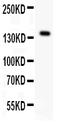 Fms Related Tyrosine Kinase 1 antibody, LS-C313099, Lifespan Biosciences, Western Blot image 
