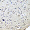 Cholinergic Receptor Nicotinic Beta 2 Subunit antibody, 23-913, ProSci, Immunohistochemistry paraffin image 