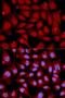 Mitogen-Activated Protein Kinase Kinase 6 antibody, LS-C332181, Lifespan Biosciences, Immunofluorescence image 
