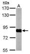 NADH:Ubiquinone Oxidoreductase Core Subunit S1 antibody, GTX105270, GeneTex, Western Blot image 