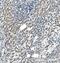 Cytochrome P450 Family 7 Subfamily A Member 1 antibody, A01601, Boster Biological Technology, Immunohistochemistry paraffin image 