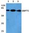 Heat Shock Protein Family A (Hsp70) Member 9 antibody, A02561S664, Boster Biological Technology, Western Blot image 