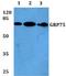 Heat Shock Protein Family A (Hsp70) Member 9 antibody, A02561S664, Boster Biological Technology, Western Blot image 