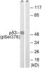 p53 antibody, LS-C199381, Lifespan Biosciences, Western Blot image 