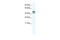 TATA-Box Binding Protein Like 2 antibody, 28-706, ProSci, Western Blot image 