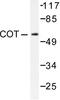 Mitogen-Activated Protein Kinase Kinase Kinase 8 antibody, LS-C175974, Lifespan Biosciences, Western Blot image 