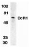 TNF Receptor Superfamily Member 10c antibody, A04218-1, Boster Biological Technology, Western Blot image 