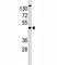BMI1 Proto-Oncogene, Polycomb Ring Finger antibody, F40323-0.4ML, NSJ Bioreagents, Western Blot image 