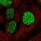 Small Ubiquitin Like Modifier 1 antibody, NBP2-54916, Novus Biologicals, Immunocytochemistry image 