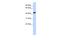 Retinol Dehydrogenase 16 antibody, A11418, Boster Biological Technology, Western Blot image 