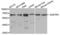 Sequestosome 1 antibody, LS-C349284, Lifespan Biosciences, Western Blot image 