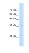 Lysosomal Protein Transmembrane 4 Alpha antibody, NBP1-59964, Novus Biologicals, Western Blot image 