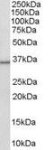 Corticosteroid 11-beta-dehydrogenase isozyme 1 antibody, PA5-18331, Invitrogen Antibodies, Western Blot image 