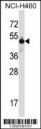 Mohawk Homeobox antibody, 57-283, ProSci, Western Blot image 