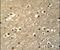 Transcription Factor AP-4 antibody, PA5-25356, Invitrogen Antibodies, Immunohistochemistry paraffin image 