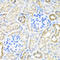 TIR Domain Containing Adaptor Protein antibody, LS-C747701, Lifespan Biosciences, Immunohistochemistry paraffin image 