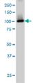 cGMP-dependent 3 ,5 -cyclic phosphodiesterase antibody, H00005138-M01, Novus Biologicals, Western Blot image 