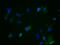 Aurora Kinase A antibody, CSB-RA223479A0HU, Cusabio, Immunofluorescence image 