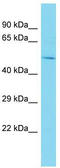 Keratin 80 antibody, TA332213, Origene, Western Blot image 