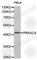 Protein Kinase CAMP-Activated Catalytic Subunit Alpha antibody, A0798, ABclonal Technology, Western Blot image 