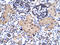 Small Nuclear RNA Activating Complex Polypeptide 2 antibody, 31-240, ProSci, Immunohistochemistry paraffin image 