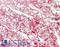 Prohibitin antibody, LS-B14840, Lifespan Biosciences, Immunohistochemistry paraffin image 