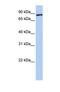 Transmembrane Protein 63A antibody, NBP1-69249, Novus Biologicals, Western Blot image 