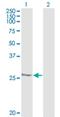 Heat Shock Protein Family B (Small) Member 1 antibody, H00003315-M04, Novus Biologicals, Western Blot image 