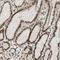 BLM RecQ Like Helicase antibody, NBP1-89929, Novus Biologicals, Immunohistochemistry frozen image 