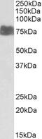 Zinc Finger GATA Like Protein 1 antibody, 42-548, ProSci, Enzyme Linked Immunosorbent Assay image 