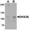 DEAH-Box Helicase 36 antibody, A04923, Boster Biological Technology, Western Blot image 