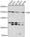 Aquarius Intron-Binding Spliceosomal Factor antibody, GTX66020, GeneTex, Western Blot image 