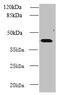 NME/NM23 Family Member 7 antibody, CSB-PA897289LA01HU, Cusabio, Western Blot image 