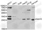 N(Alpha)-Acetyltransferase 10, NatA Catalytic Subunit antibody, A7009, ABclonal Technology, Western Blot image 