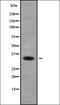 Phosphatidylinositol Transfer Protein Alpha antibody, orb338542, Biorbyt, Western Blot image 