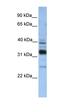 Thioredoxin Related Transmembrane Protein 4 antibody, orb325493, Biorbyt, Western Blot image 