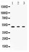 Protein Kinase CAMP-Dependent Type I Regulatory Subunit Alpha antibody, A00699-1, Boster Biological Technology, Western Blot image 