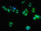 Signal Recognition Particle 54 antibody, LS-C396759, Lifespan Biosciences, Immunofluorescence image 