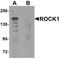 Rho Associated Coiled-Coil Containing Protein Kinase 1 antibody, PA5-21130, Invitrogen Antibodies, Western Blot image 