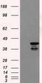 Death Associated Protein Kinase 2 antibody, GTX84630, GeneTex, Western Blot image 