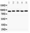 Aryl Hydrocarbon Receptor Nuclear Translocator antibody, LS-C343988, Lifespan Biosciences, Western Blot image 