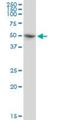 Poly(A) Binding Protein Cytoplasmic 5 antibody, H00140886-B01P, Novus Biologicals, Western Blot image 